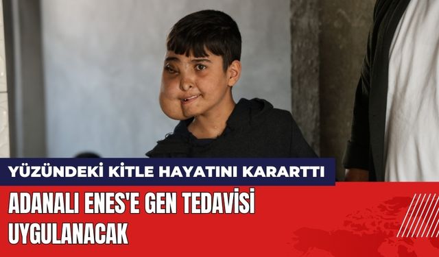 Adanalı Enes'e Gen Tedavisi Uygulanacak