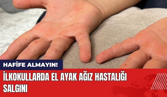 İlkokullarda El Ayak Ağız Hastalığı Salgını!