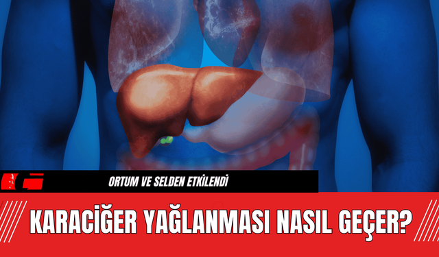 Karaciğer Yağlanması Nasıl Geçer?