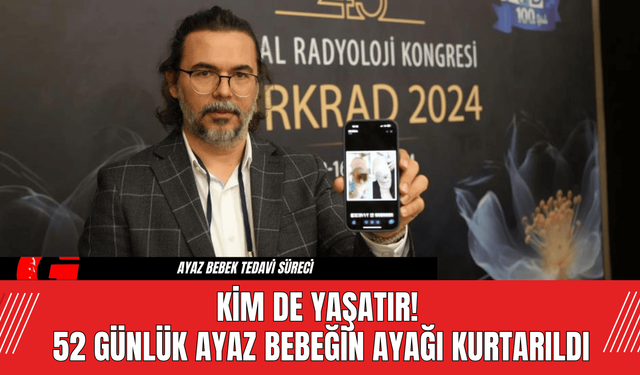 Kim De Yaşatır! 52 Günlük Ayaz Bebeğin Ayağı Kurtarıldı