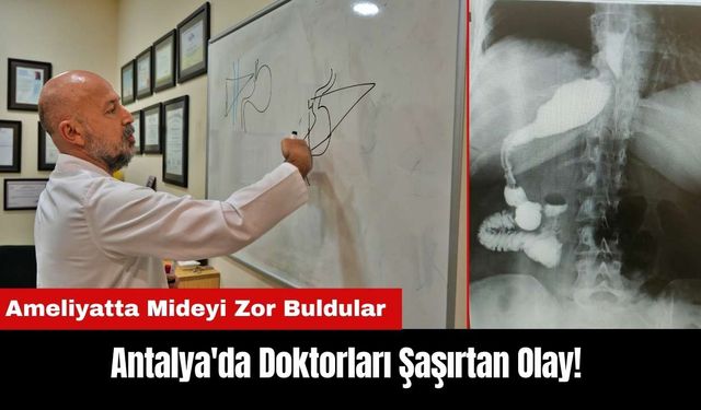 Antalya'da Doktorları Şaşırtan Olay! Ameliyatta Mideyi Zor Buldular