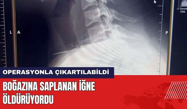 Boğazına Saplanan İğne Öldürüyordu