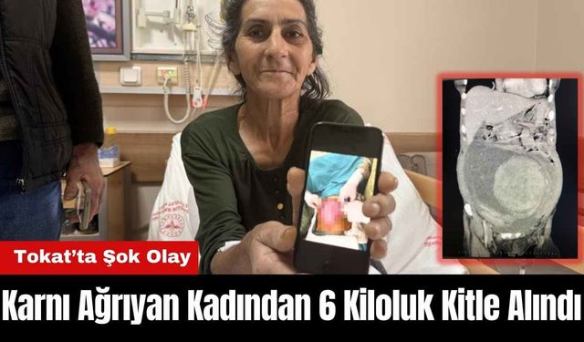 Karnı Ağrıyan Kadından 6 Kiloluk Kitle Alındı