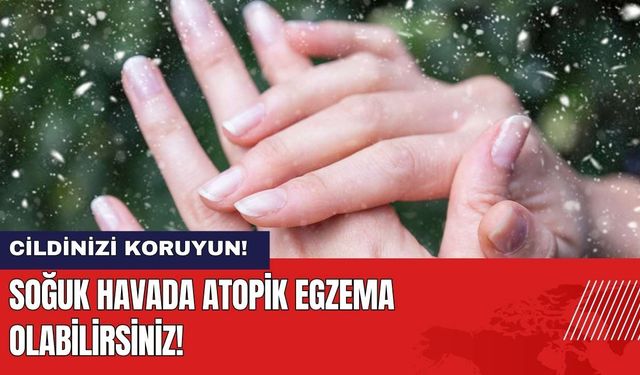 Soğuk Havada Cildinizi Koruyun! Atopik Egzema Olabilirsiniz