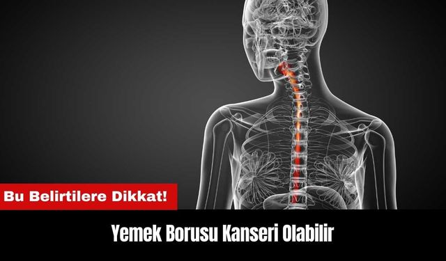 Bu Belirtilere Dikkat! Yemek Borusu Kanseri Olabilir