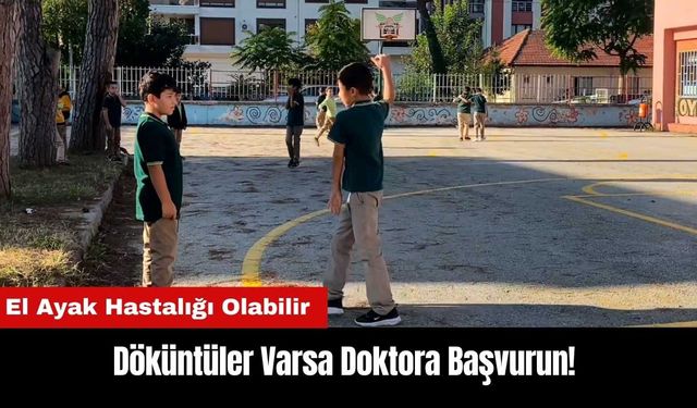 Döküntüler Varsa Doktora Başvurun! El Ayak Hastalığı Olabilir