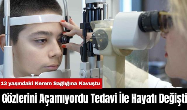 Gözlerini Açamıyordu Tedavi İle Hayatı Değişti