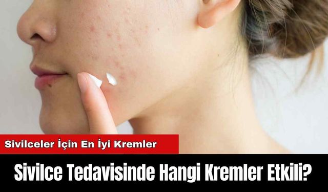 Sivilce Tedavisinde Hangi Kremler Etkili? Sivilceler İçin En İyi Kremler