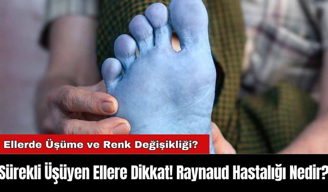 Sürekli Üşüyen Ellere Dikkat! Raynaud Hastalığı Nedir?