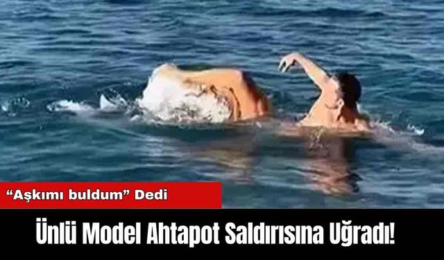 Ünlü Model Ahtapot Saldırısına Uğradı!