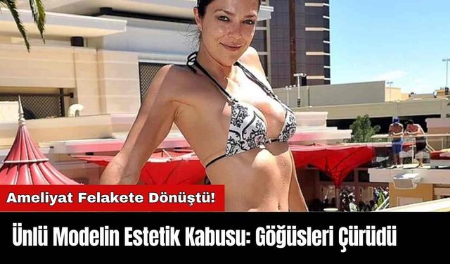 Ünlü Modelin Estetik Kabusu: Göğüsleri Çürüdü