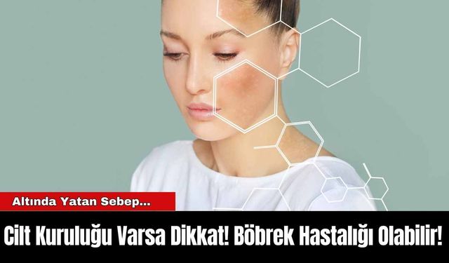 Cilt Kuruluğu Varsa Dikkat! Böbrek Hastalığı Olabilir!