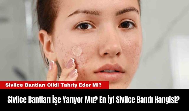 Sivilce Bantları İşe Yarıyor Mu? En İyi Sivilce Bandı Hangisi?