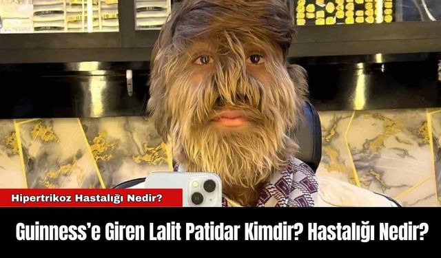 Guinness’e Giren Lalit Patidar Kimdir? Hastalığı Nedir?