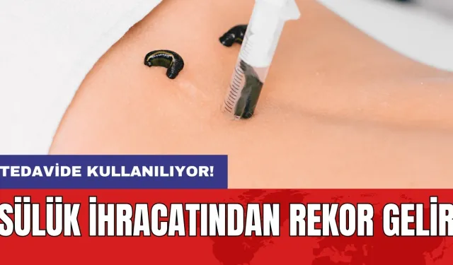 Tedavide kullanılıyor: Sülük ihracatından rekor gelir