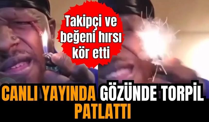 Canlı yayında gözünde torpil patlattı