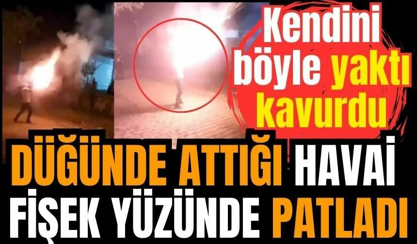 Düğünde attığı havai fişek yüzünde patladı