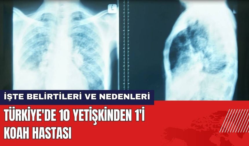 Türkiye'de 10 Yetişkinden 1'i KOAH Hastası