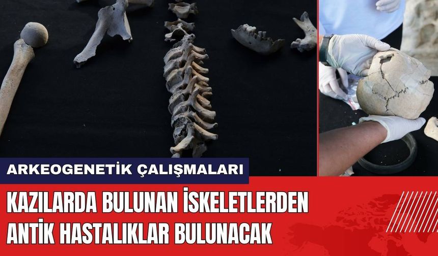 Kazılarda Bulunan İskeletlerden Antik Hastalıklar Bulunacak